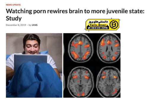 تماشای پورن ساختار مغز رو تغییر میده🧠