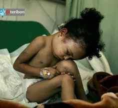 ⭕ ️طبق گزارش نیویورک تایمز در یمن هر ۵دقیقه ۱کودک جان مید