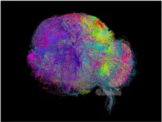 مغز دارای ۸۶ میلیاردسلول عصبیه که با۱۰۰تریلیون رشته بهم و