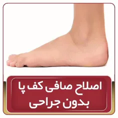 اصلاح صافی کف پا بدون جراحی کلینیک نادر