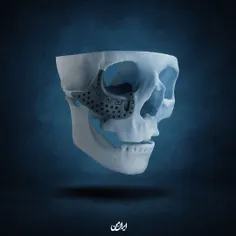 💀 علم جوان‌های ایرانی جایی می‌درخشه که اگه جمجمه کودکی آس