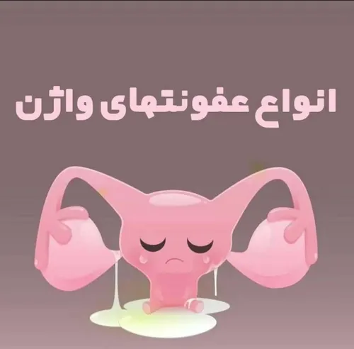 🔰نکته مهم