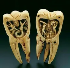 اسطورۀ کرم و دندان درد