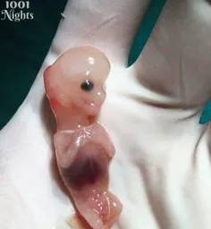 تصویر جنین سقط شده 7 هفته ای
