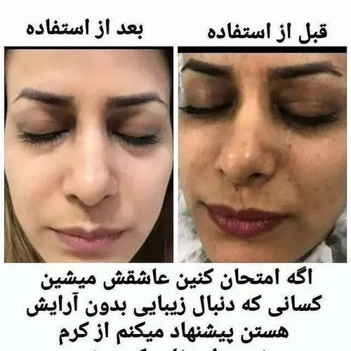 رضایت مشتری گلم از کرم وی ای پی صورت