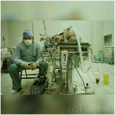 تصویر یک جراح قلب پس از عمل موفقیت آمیز قلب که 23 ساعت به