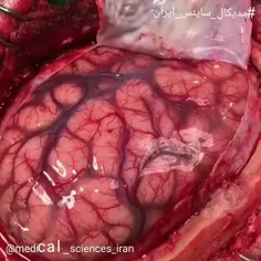 🧠 مغز را از نزدیک ببینید