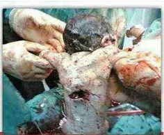 عکسی  که دنیا رو تکون داد گلوله سربازاسراییلی درداخل شکم 