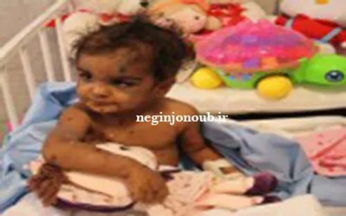 نگین جنوب:حمله به ناپدری ستایش سه ساله کودک رفسنجانی در ز