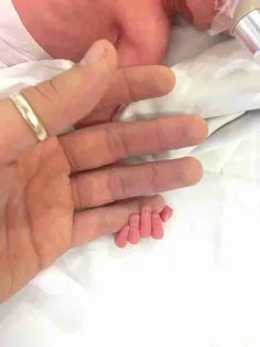 دست دوستم و مريض کوچولوش....