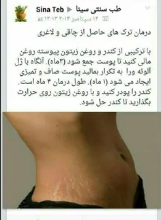 سلامت و تندرستی mobin-70 17208889