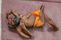 یک روحانی هندو در هندوستان با بیماری عجیبی دست و پنجه نرم