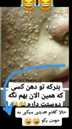 تودهن هرکی که دوسم نداره😂 😂