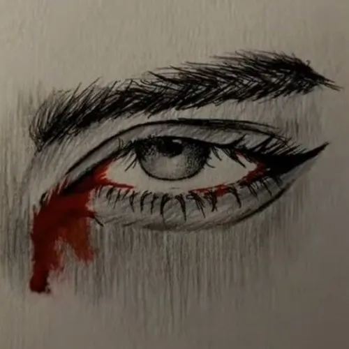 bloody eye