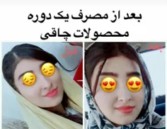 بعد مصرف یک دوره از کپسول چاقی صورت