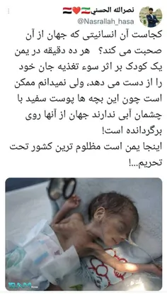 اونوقت ی انگلی میگ ۶۴ روز اعتصاب غذا کرده و پاهاش شکسته، 