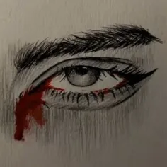 bloody eye 