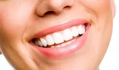 علت اصلی پوسیدگی دندان چیست؟
