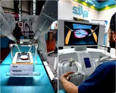 تصویری از جراحی از راه دور توسط ربات ایرانی