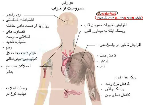 گوناگون soltan.reza.890 26880331 - عکس ویسگون