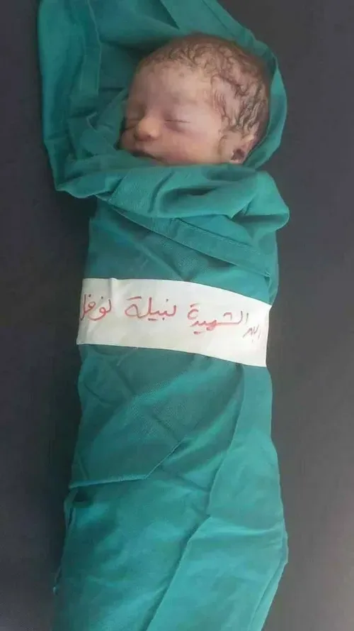 کوچکترین شهید نوار غزه نبیله نوفل تنها ۷ روز سن دارد!!!