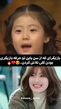 بلاکید 🙈✨