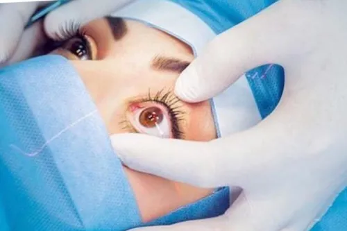 چشم های قهوه ای یک لایه آبی زیرشان است و میتوان با جراحی 