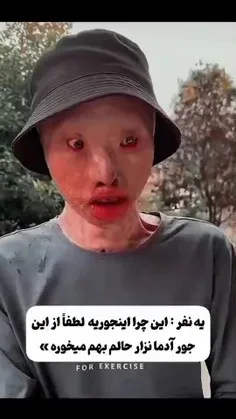 بعدش دوست دخترش ولش کرد بخاطر ظاهرش........💔