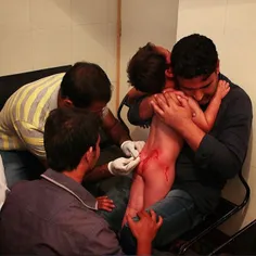 Paramedics treating baby Burhan bitten by stray dogs at a