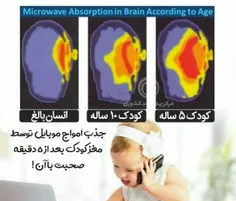 جذب امواج موبایل توسط مغز کودک بعد از ۵ دقیقه صحبت با آن!