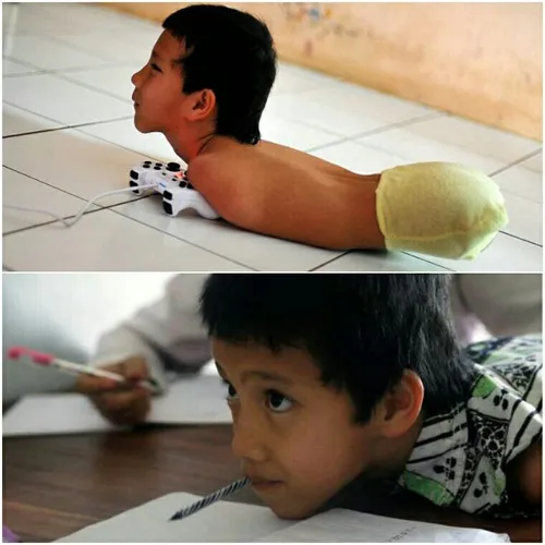 تیو ساتریو" پسر معلول اندونزیایی که از نعمت داشتن دست و پ