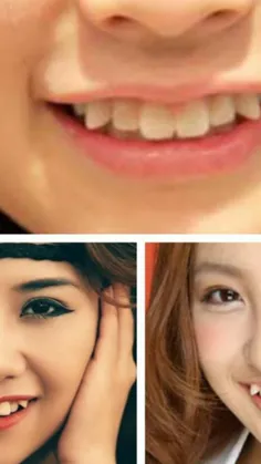 "دندان دراکولا" این مد در ژاپن آنقدر محبوب شده است