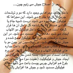 مشکل همه هس