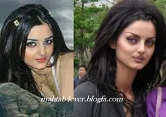 مه لقا جباری قبل و بعد عمل جراحی زیبایی