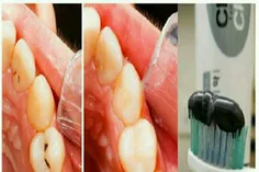 خمیر دندانی که دندانپزشکان را بیکار میکند!
