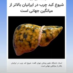 🔰 کبد مهمترین عضو است که اگر خوب کار کند؛ پوست شفاف و تمی