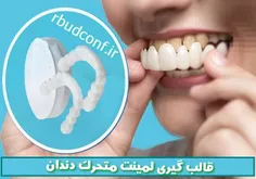 تکنیک قالب گیری لمینت متحرک دندان در منزل بدون نیاز به لوازم خاص