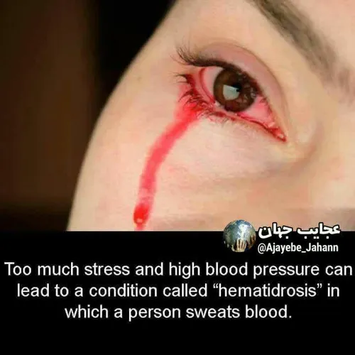 اشک خون واقعیت دارد