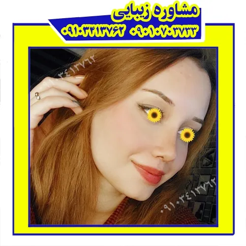 جراحی زیبایی بینی