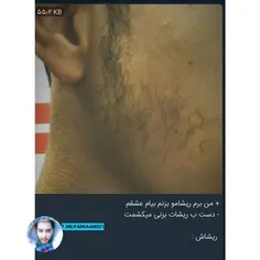 ریش دوس پسرش 😂 | فرکام