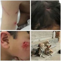 ⭕ ️ حمله #سگ به یک کودک ۷ ساله در شهر تفت