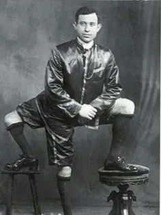 فرانچسکو لنتینی، مرد 3 پای ایتالیایی که به طور غیر طبیعی 