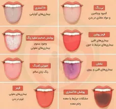 🌱رنگ زبان بیانگر چیست؟