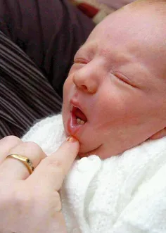 کودکی که با دو تا دندان بدنیا آمد
