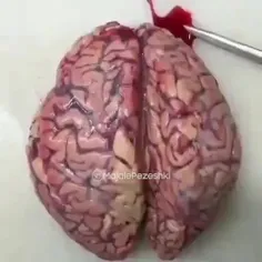 تا حالا برش و داخل مغز رو دیده بودید؟.