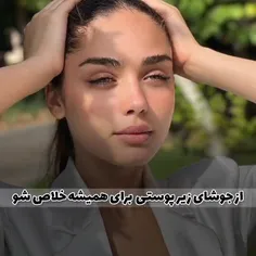 بااین ترفند از جوشای زیر پوستی برای همیشه خلاصشو🫶