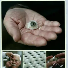 چشم‌های دست‌ساز«گرهارد گراینر» یک چشم ساز آلمانی است،‌ او