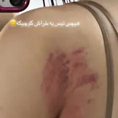 چه کبودی شدم