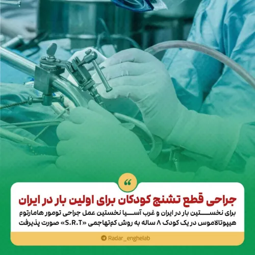 جراحی برای رفع تشنج کودکان برای اولین بار در ایران