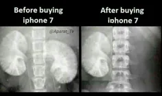 قبل و بعد از خریدن ایفون هفت